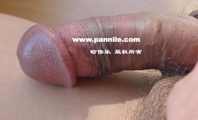 勃起阴茎